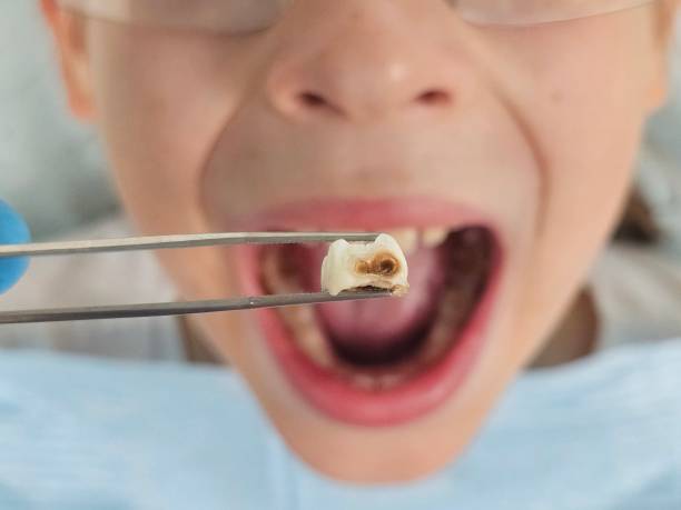 Emergency Gum Pain Relief in WI
